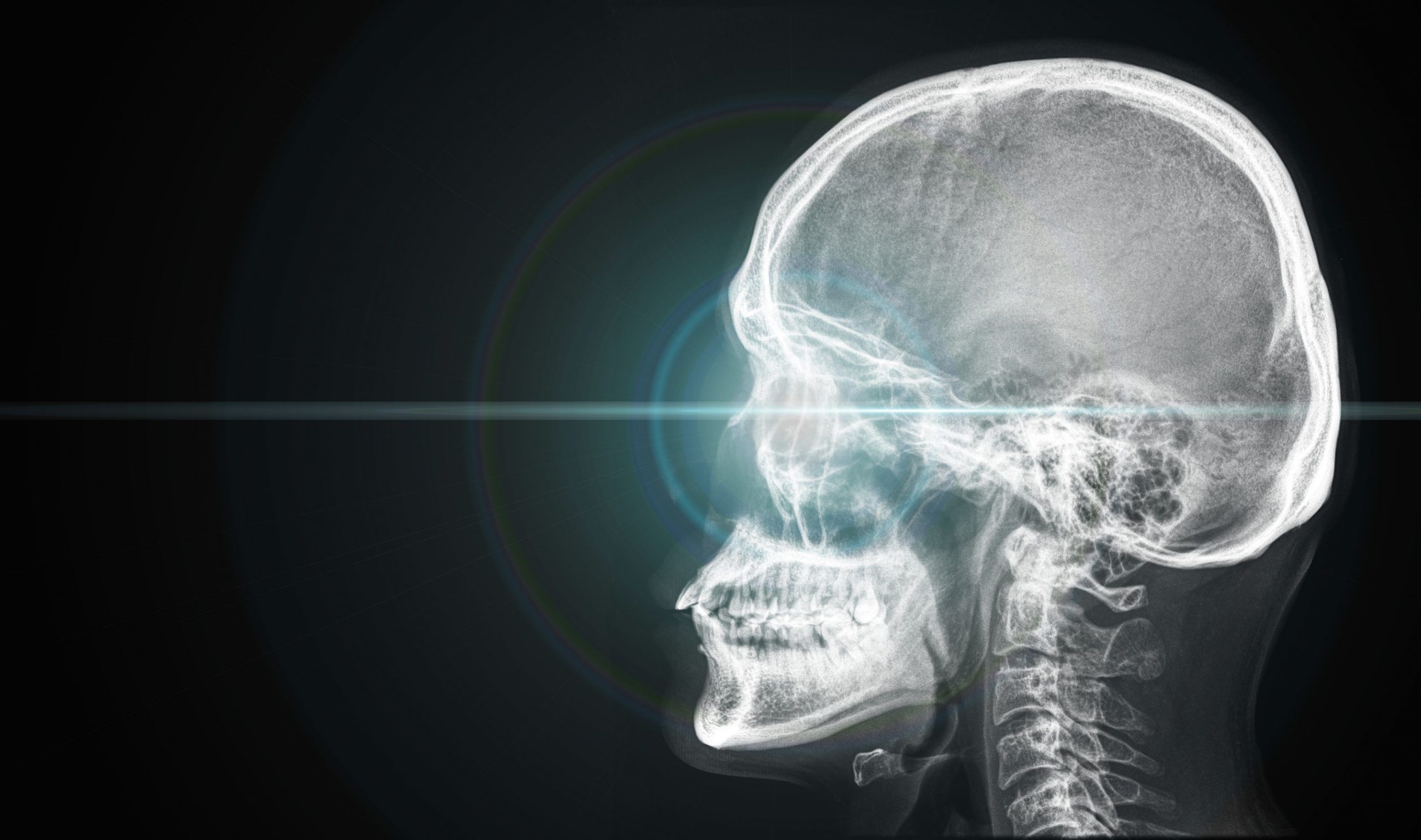 The Hidden Effects of Head Injuries